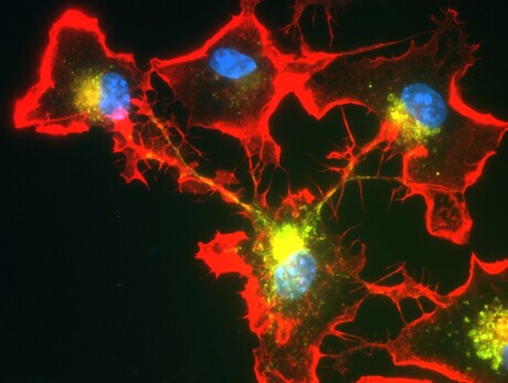 Immune cells in the brain can cooperate when needed Immune cells in the brain can cooperate when needed