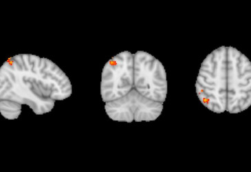 Intestinal drug found to boost memory and cognition Intestinal drug found to boost memory and cognition