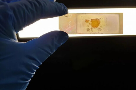 Colour-changing microscope slides can detect cancer