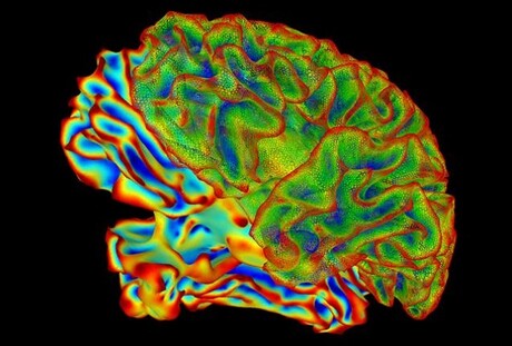 Alzheimer&#39;s spreads differently to how we thought