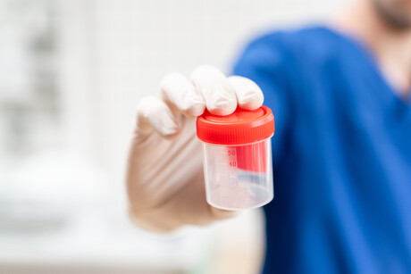A urine test for intermediate-risk prostate cancer