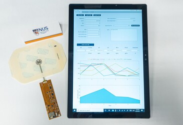 Smart bandage enables onsite chronic wound monitoring Smart bandage enables onsite chronic wound monitoring
