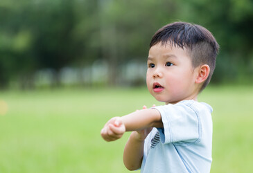Immune cells in the skin play a surprising role in allergies Immune cells in the skin play a surprising role in allergies