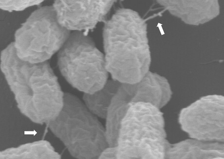 Scientists uncover antibiotic-resistance gene in <em>E. coli</em>