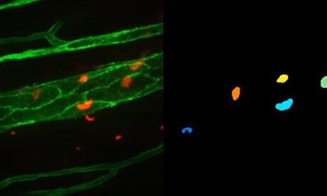 Computer vision system analyses cells in microscopy videos