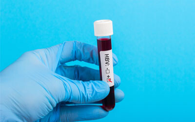 Hepatitis B: new recommendations for clinicians