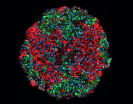Functional pancreatic beta cells produced from stem cells
