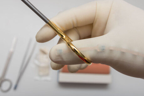 Liverpool Hospital trials smart gloves to train surgeons