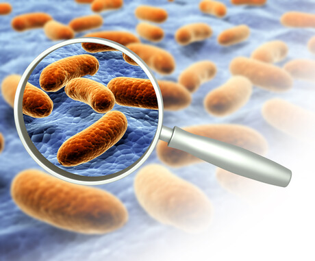 Salmonella and chocolate: why does it happen? Salmonella and chocolate: why does it happen?