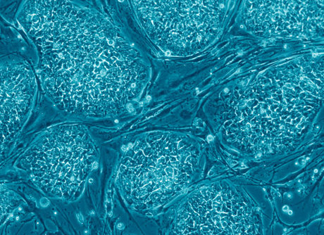 Mesoblast to head to phase III for stem cell treatment for spinal fusion Mesoblast to head to phase III for stem cell treatment for spinal fusion