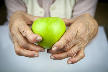 Genes can help predict response to arthritis treatment Genes can help predict response to arthritis treatment