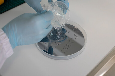 Pin-prick test could pick early signs of heart attack, stroke Pin-prick test could pick early signs of heart attack, stroke