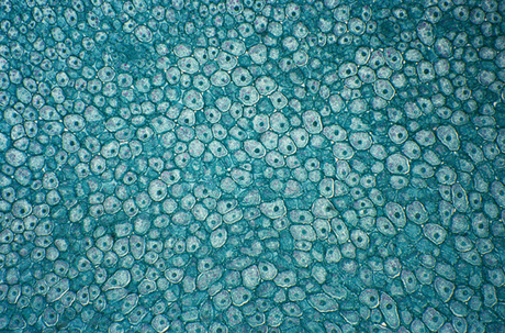 Mesoblast gets FDA all-clear for arthritis stem cell trial