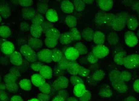 Visualising mRNA molecules in the brains of live mice Visualising mRNA molecules in the brains of live mice