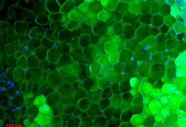 Diabetes drug to correct metabolic abnormalities Diabetes drug to correct metabolic abnormalities