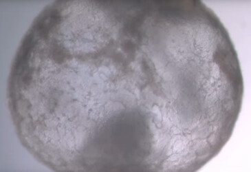 Synthetic embryo models created solely from stem cells Synthetic embryo models created solely from stem cells
