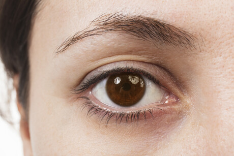 Retinal damage a marker of MS severity