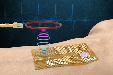 Researchers fabricate chip-free, wireless &#39;e-skin&#39;