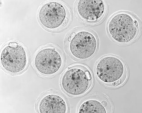 Some immunotherapy treatments may damage female fertility