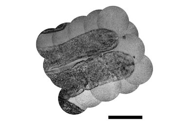 High-res imaging with a flexible and ultrathin endoscope