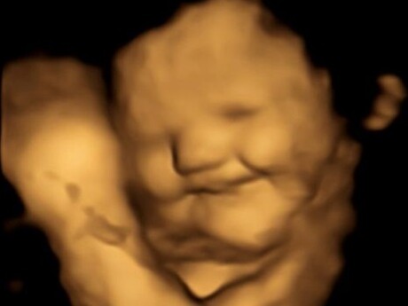 Babies observed reacting to taste and smell in the womb