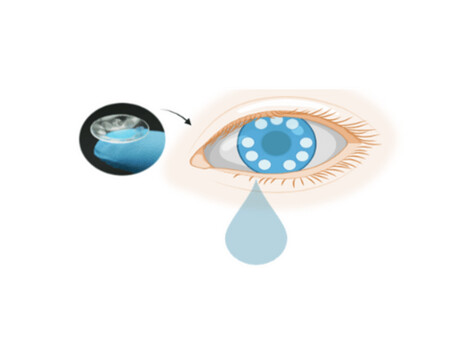 Smart contact lenses enable cancer diagnostics, screening