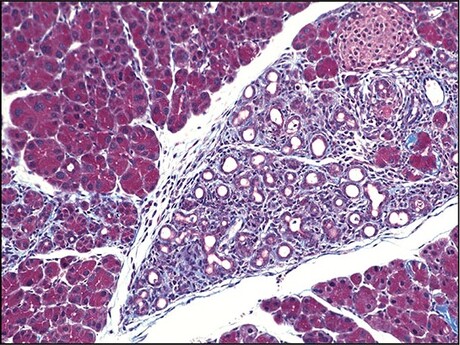 Researchers identify key player in cellular response to stress Researchers identify key player in cellular response to stress