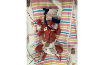 Doctors perform life-changing surgery on baby before birth