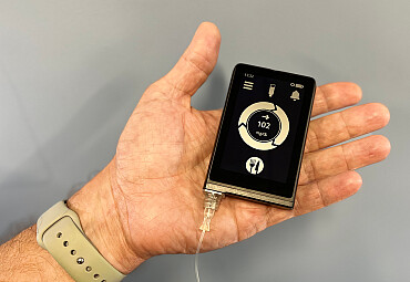 Bionic pancreas simplifies type 1 diabetes management