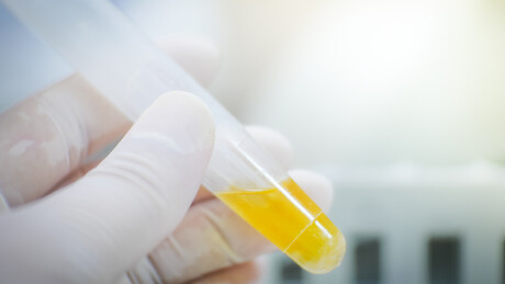Urine could play a key part in biotech systems