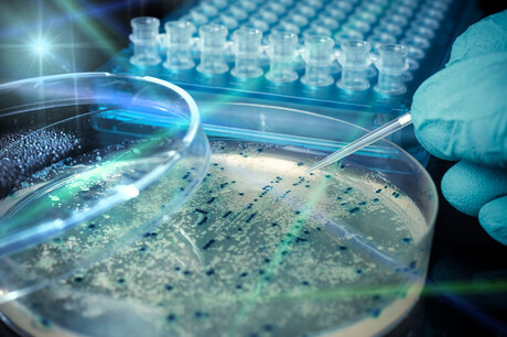 One in eight deaths linked to bacterial infections