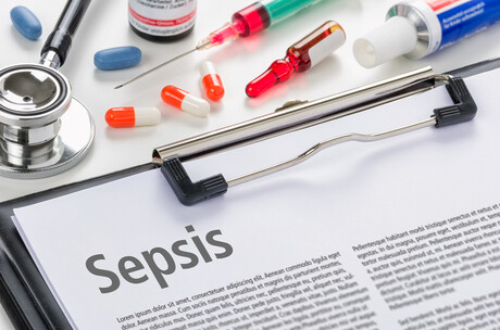 Study aims to save lives with new sepsis testing