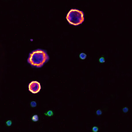 Australia &#39;behind&#39; on cancer liquid biopsy technology