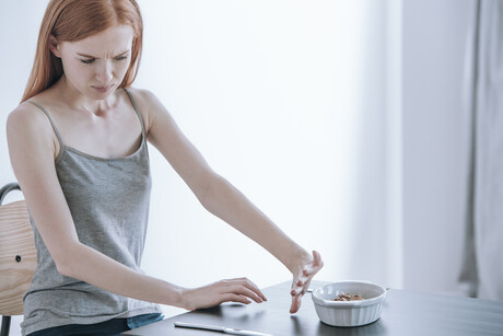 Eating disorder ARFID found to be highly heritable Eating disorder ARFID found to be highly heritable