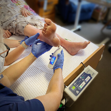 Scanner can detect bedsores up to five days earlier