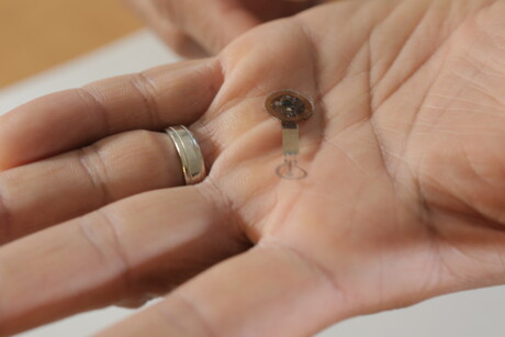 E-bandage speeds healing by 30%, alerts clinicians to issues