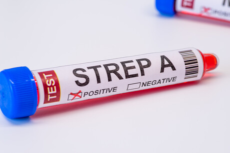 New Strep A variant: research urges enhanced international surveillance