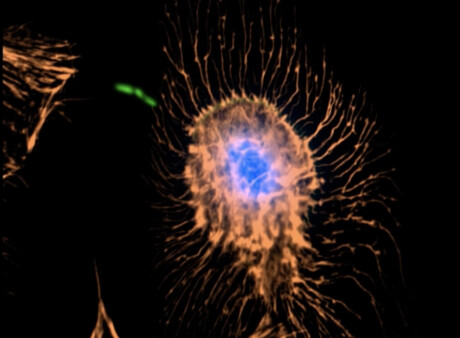 Smart microscopy &mdash; where to take the picture?