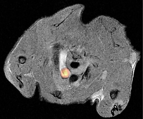 Non-invasive imaging used to study atherosclerosis Non-invasive imaging used to study atherosclerosis