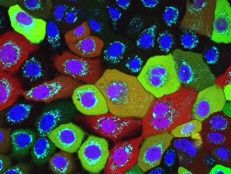 Intracellular sensor warns of damage to mitochondria Intracellular sensor warns of damage to mitochondria