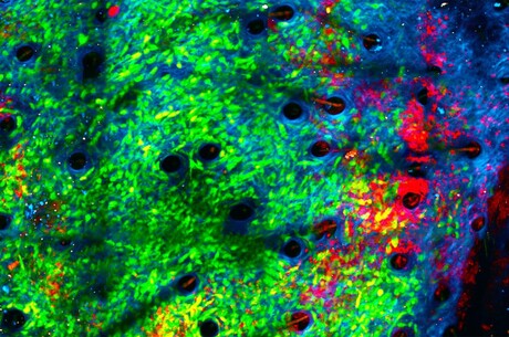 Bacteria can help the immune system destroy tumours