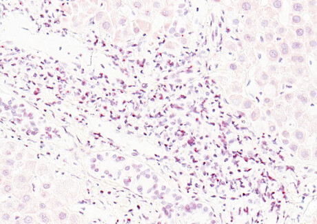 Many viruses persist in our bodies for life Many viruses persist in our bodies for life