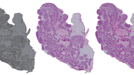 AI-based method replaces chemical staining of tissue AI-based method replaces chemical staining of tissue