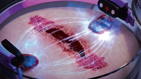 How electricity could heal wounds three times faster