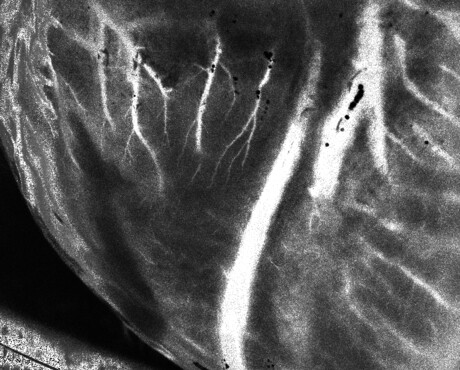 Assessing donor hearts with laser speckle imaging Assessing donor hearts with laser speckle imaging