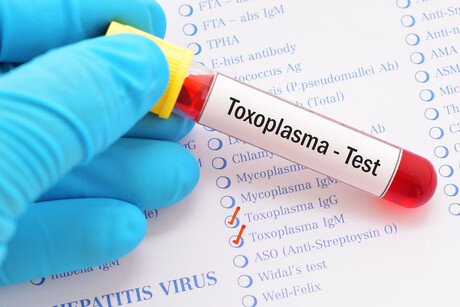 Recurrent toxoplasmosis more common in women: research