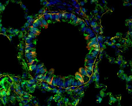 Peptide drug could treat long COVID, prevent reinfection Peptide drug could treat long COVID, prevent reinfection