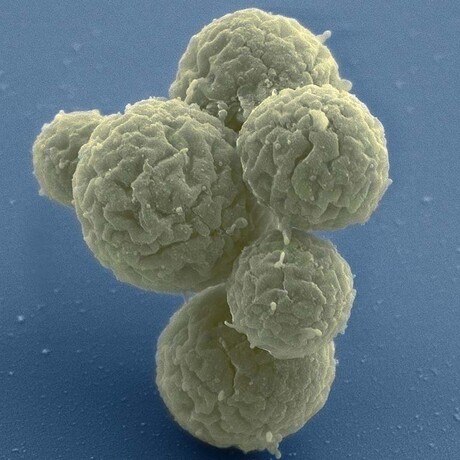 Evolution of artificial cells shows that life finds a way Evolution of artificial cells shows that life finds a way