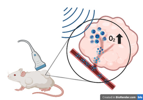 Extra oxygen could overcome radiotherapy resistance in tumours Extra oxygen could overcome radiotherapy resistance in tumours
