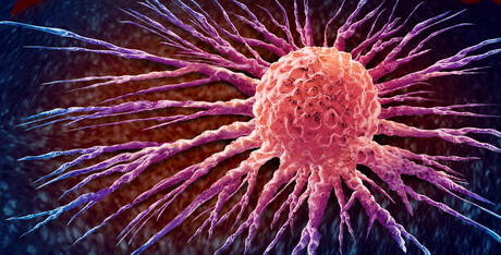 Protein blockers could stop cancer spread Protein blockers could stop cancer spread